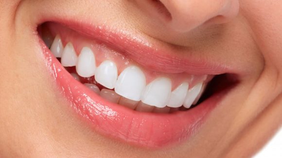 Blanqueamiento Dental – Una tendencia popular Blanqueamiento Dental – Una tendencia popular